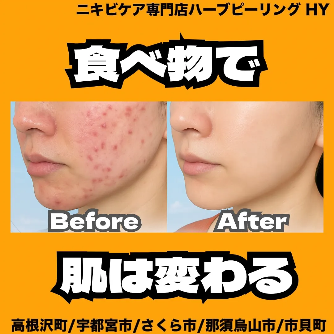 【食べ物で肌は変わる】