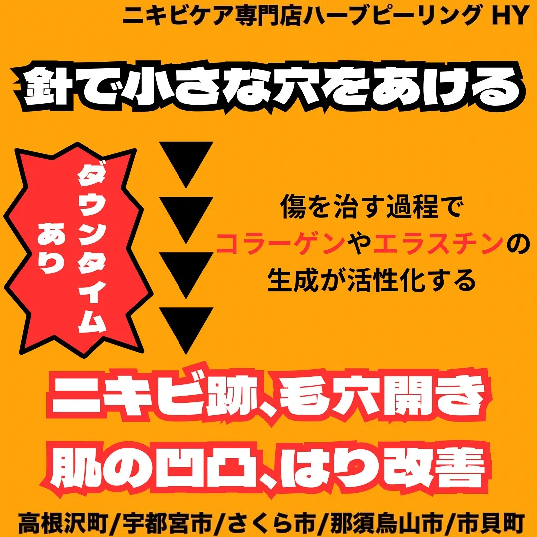 【今さら聞けない！どの美容施術が何に効くの？】