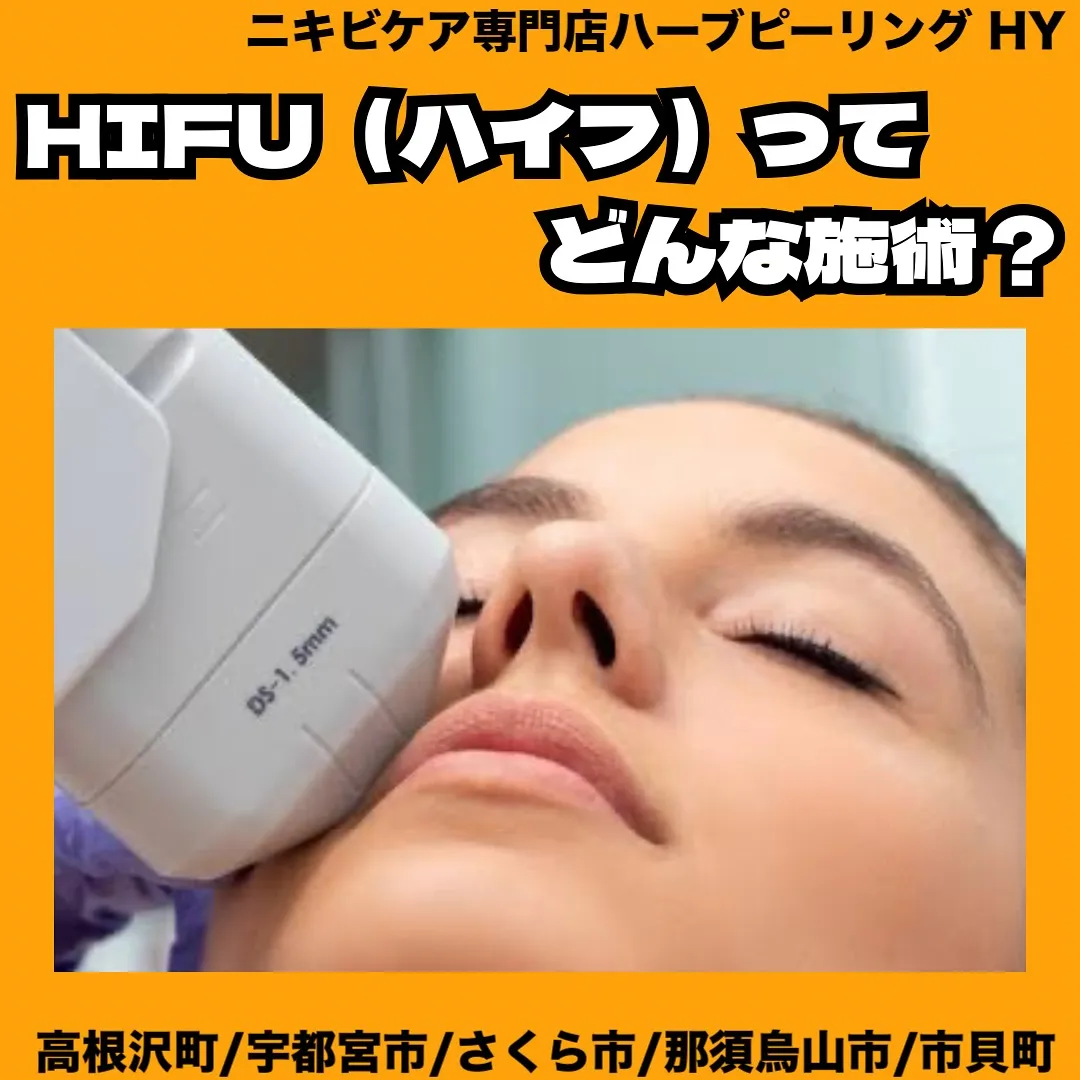 【HUFU（ハイフ）ってどんな施術？】