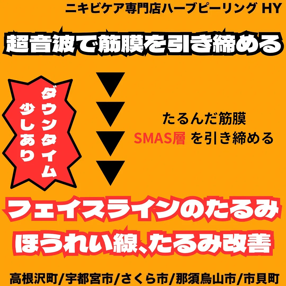 【HUFU（ハイフ）ってどんな施術？】
