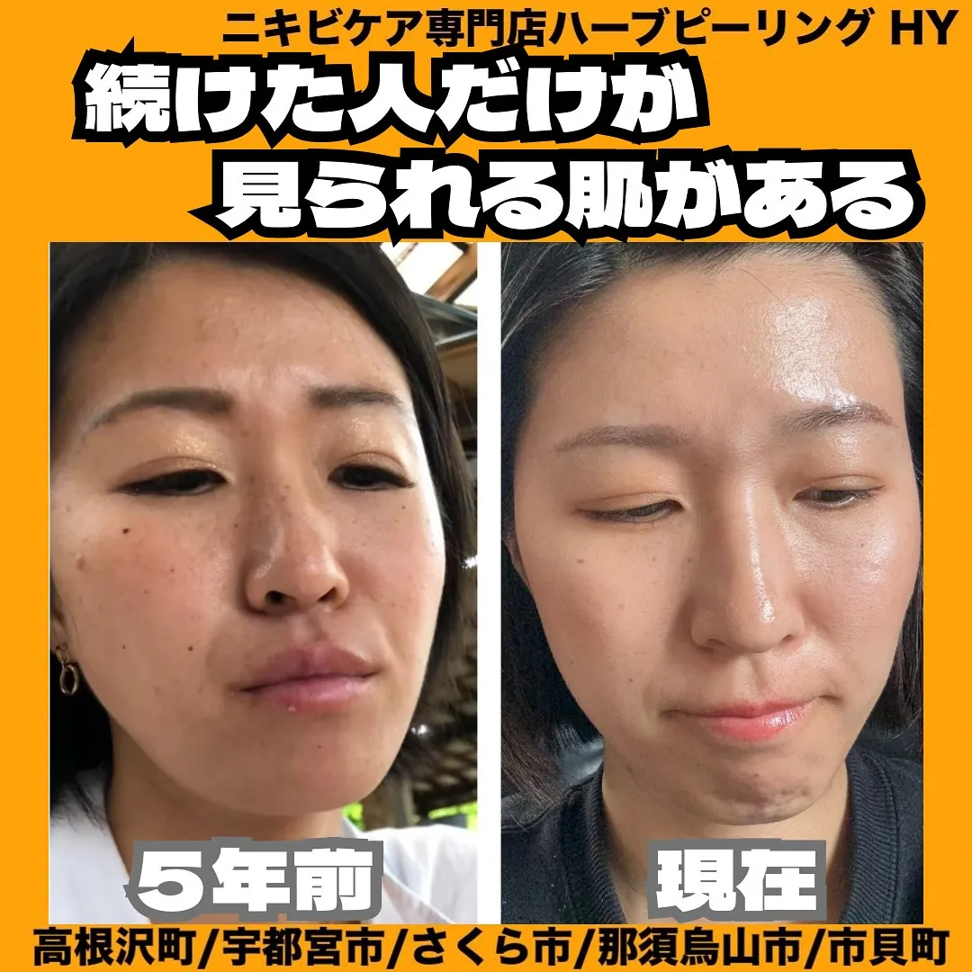 【続けた人だけが見られる肌がある】