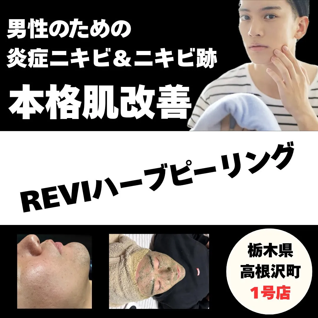 🧴【男性限定】本気で肌を変えたいなら…