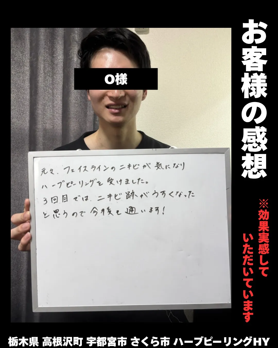 🔁【なぜニキビは何度も繰り返すの？】