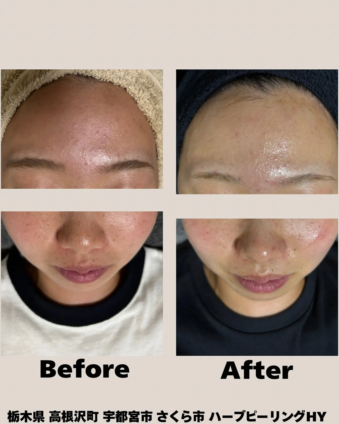 🌿お客様症例 Before→After
