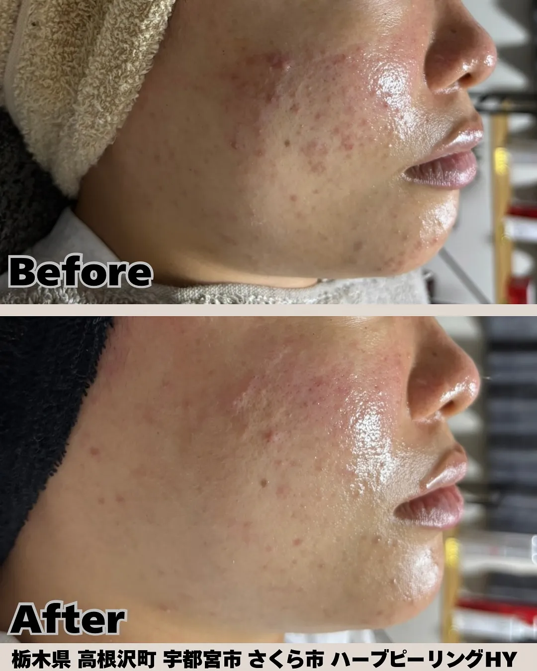 📅たった2週間でこの変化✨