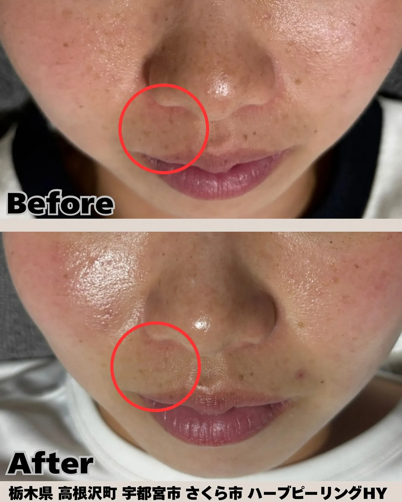 ✨サロンケア×ホームケアで変化のスピードがぐんとUP✨