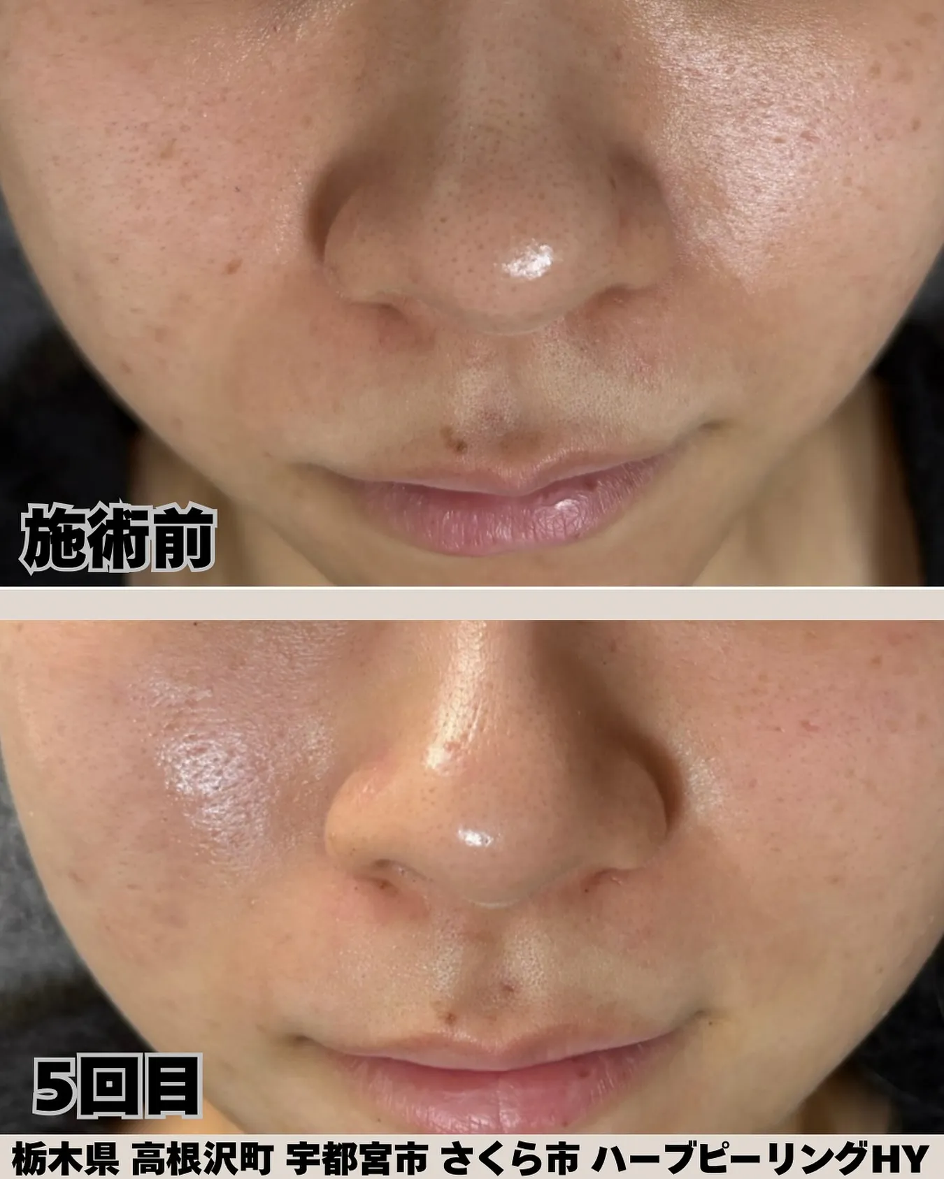 「5回目でここまで変わるなんてびっくり！