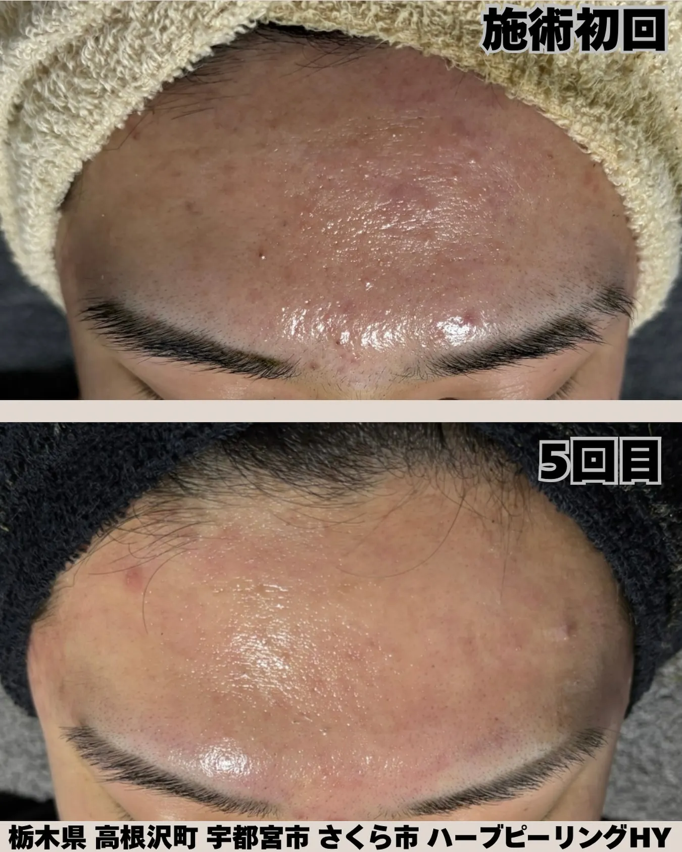 3日間紹介している、同じ高校生のお客様😊