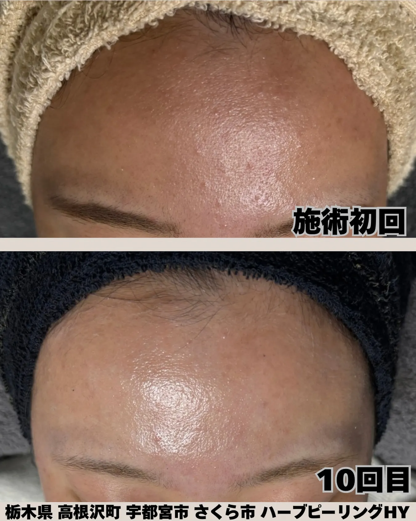 【肌の変化、ここが一番わかりやすい✨】