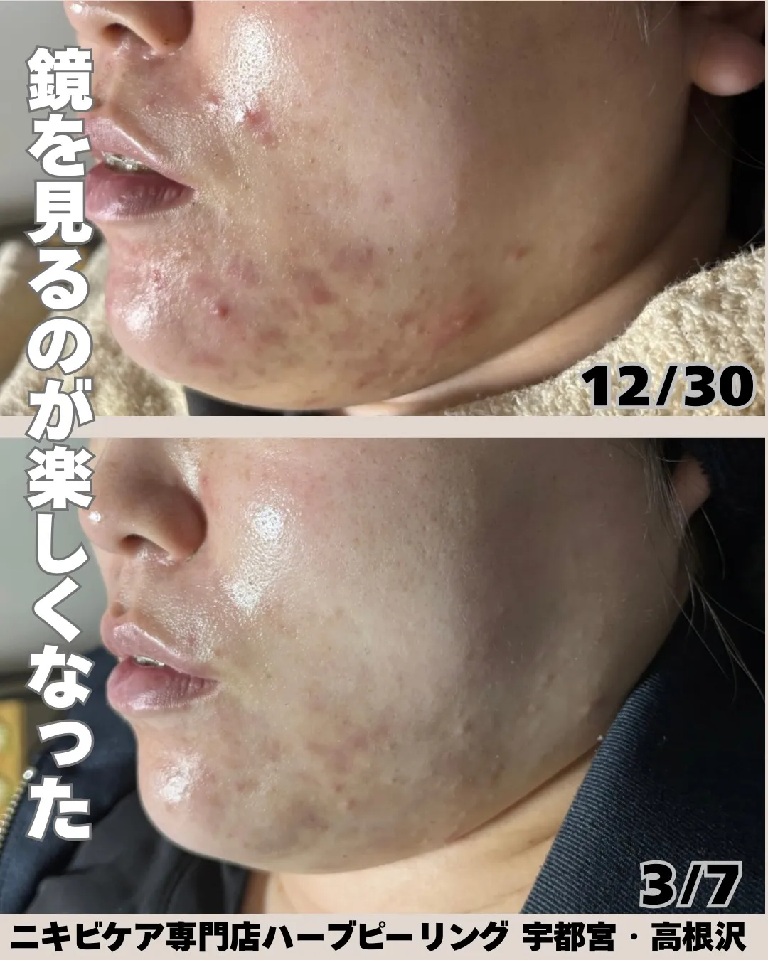 「鏡を見るのが楽しくなった✨」