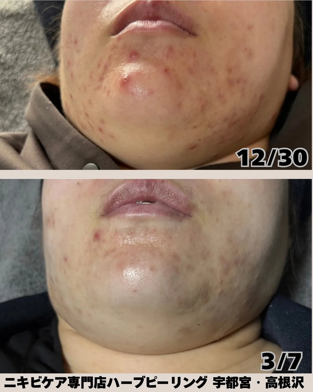 「鏡を見るのが楽しくなった✨」