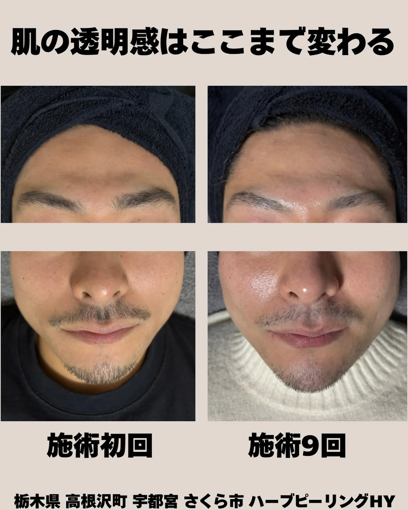 「肌の透明感、ここまで変わる✨」