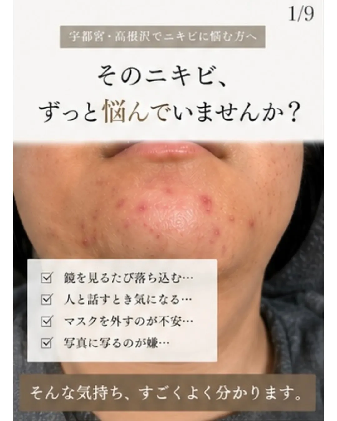 「そのニキビ、ずっと悩んでいませんか？」