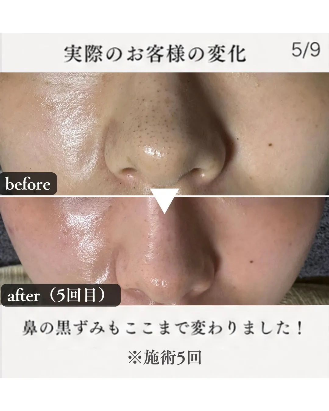 正直、これ驚かれます。