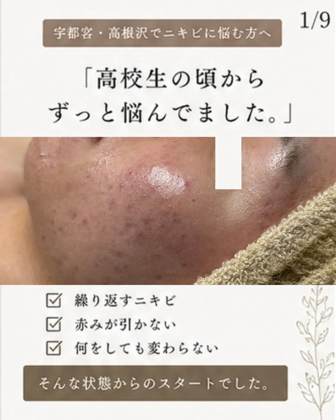 「高校生の頃からずっと悩んでました。