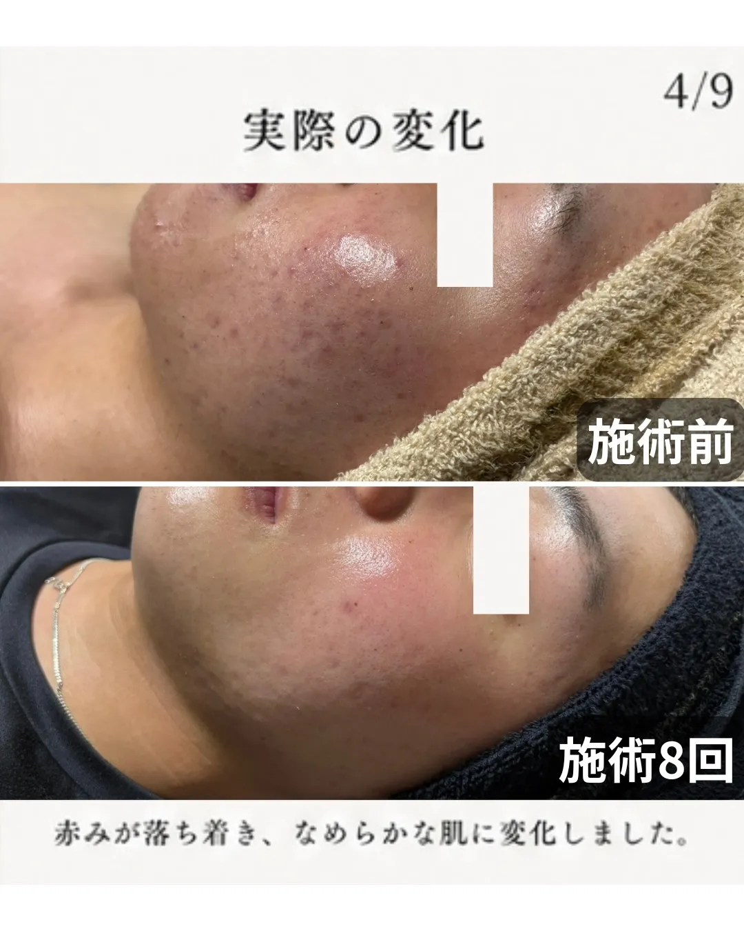 「高校生の頃からずっと悩んでました。