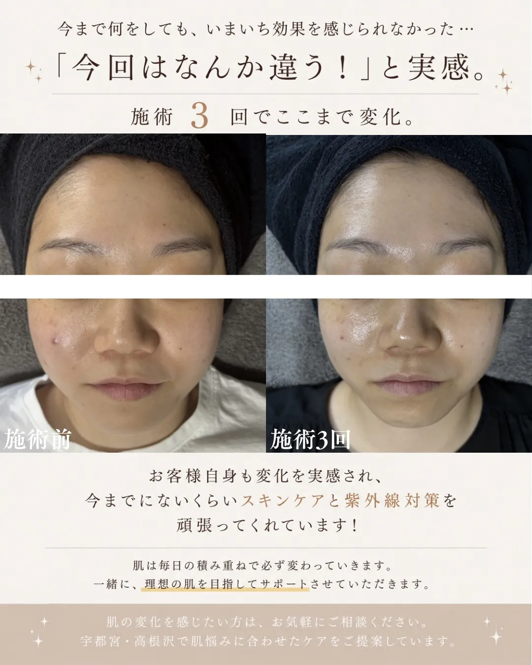 「今まで何をしても、いまいち効果を感じられなかった…」