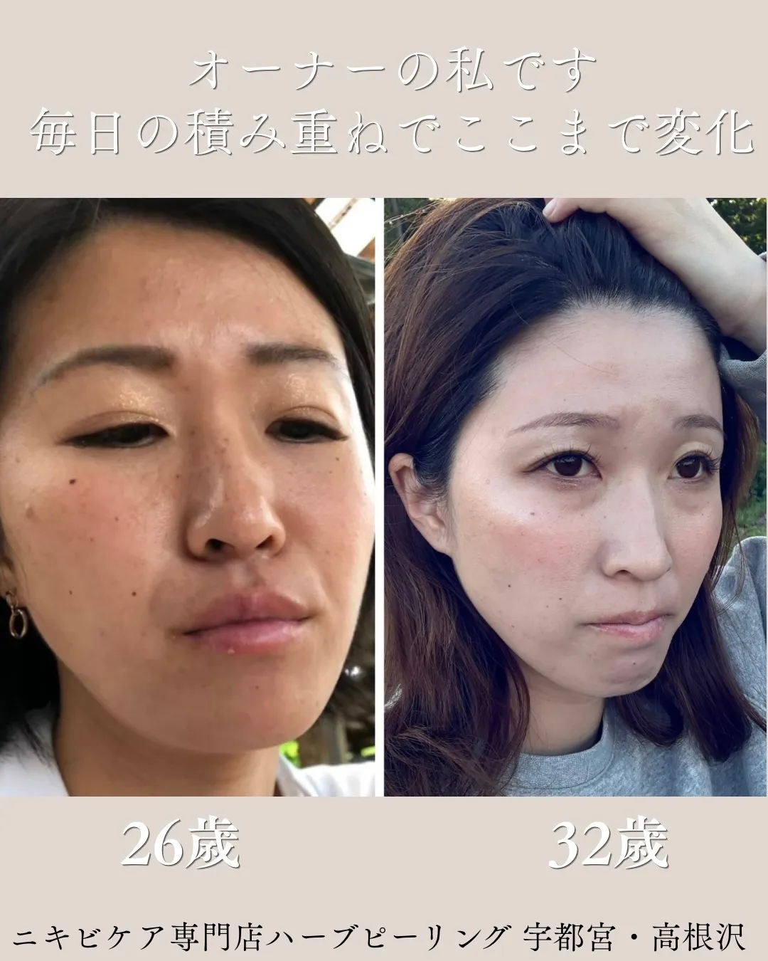 左が26歳。