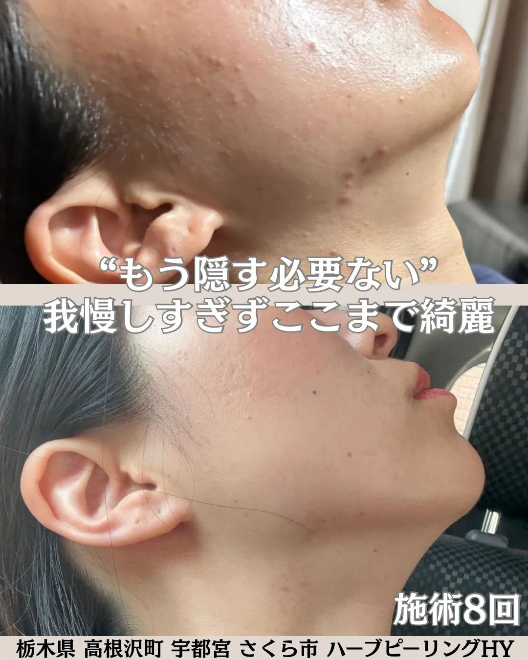 マスクが擦れたり