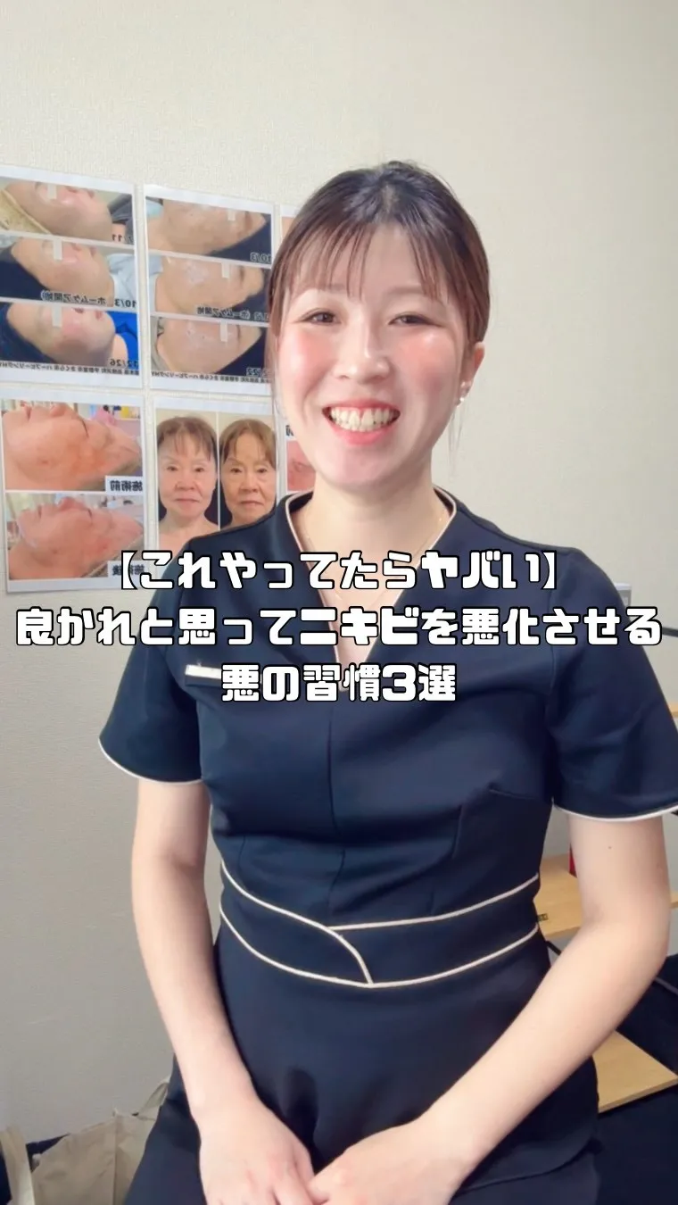 【これやってたらヤバい】良かれと思ってニキビを悪化させる悪の...