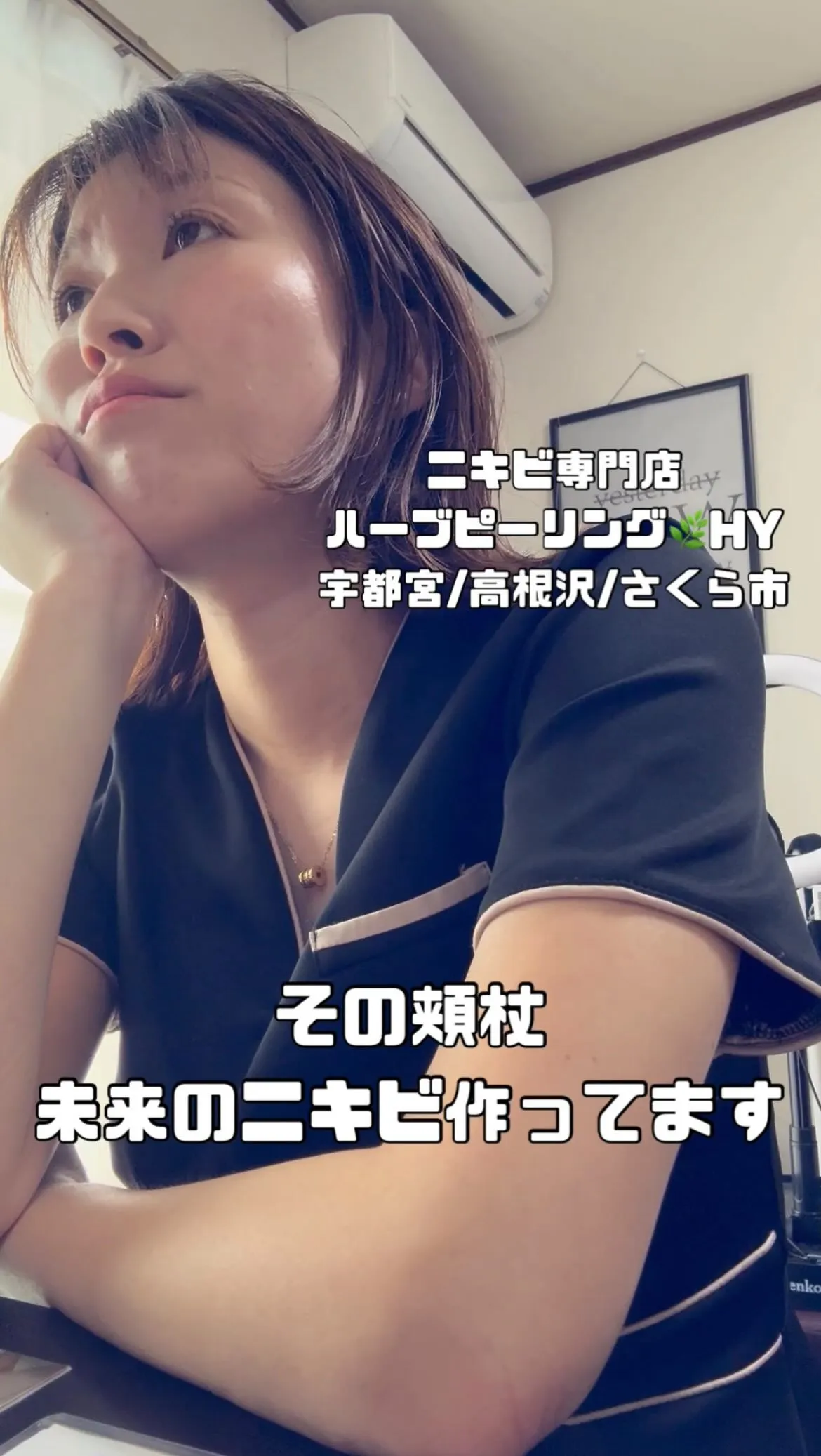 その頬杖！未来のニキビ作ってます😨🖤