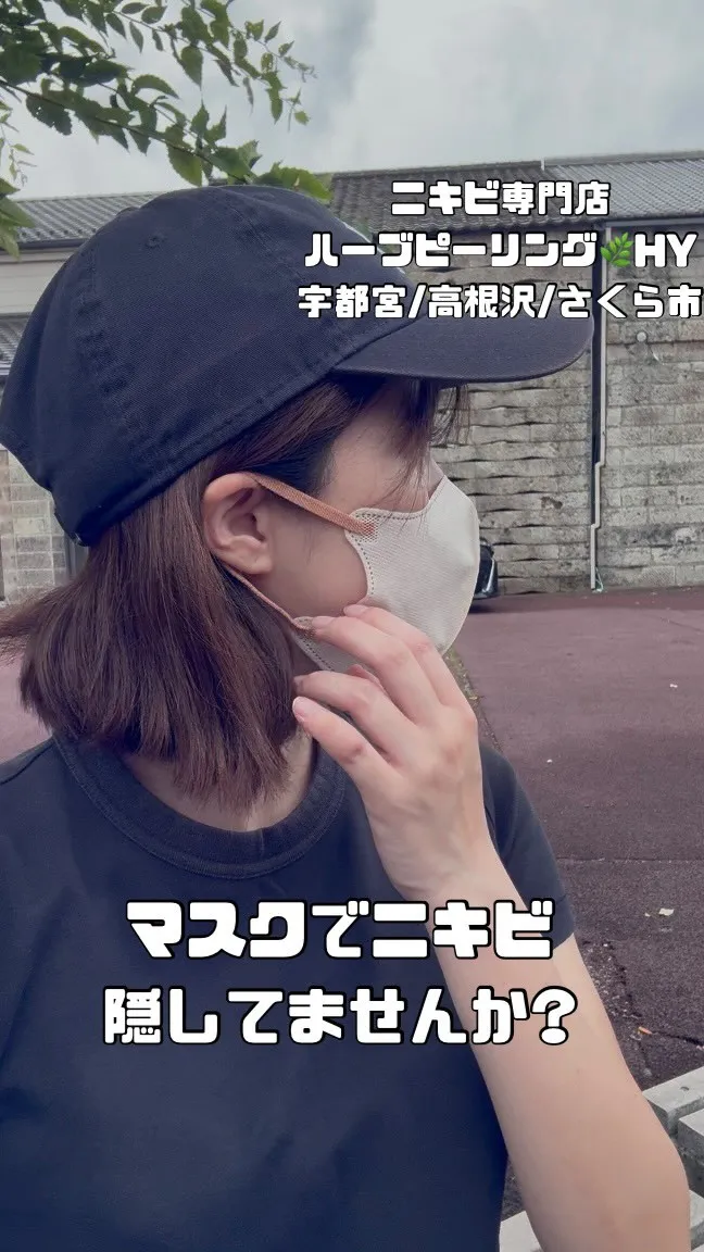 マスクでニキビ隠してませんか？