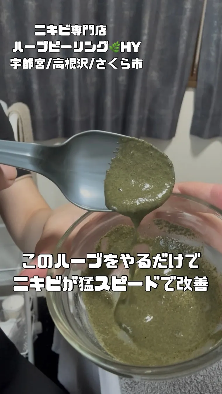 このハーブをやるだけでニキビが猛スピードで改善🌿